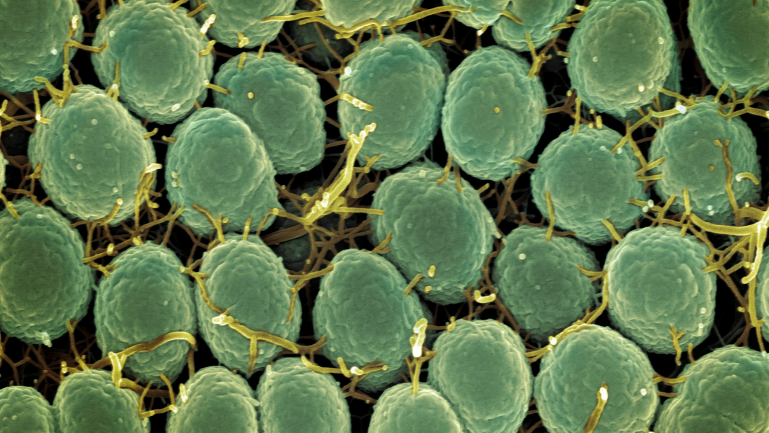 Should You Get a Gut Microbiome Test? Singapore Guide